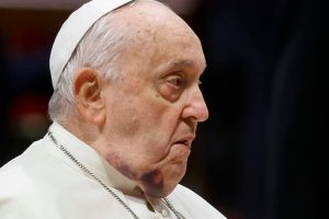 Papież Franciszek miał nieprzyjemny wypadek. Fotro: PAP/EPA